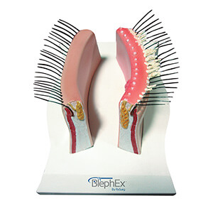 Blephex Diagram